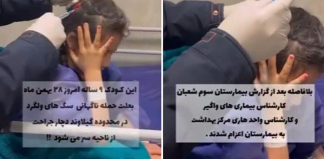 حمله ناگهانی سگ بلاصاحب به یک کودک ۹ ساله در دماوند